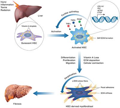 Targeting Mechanotransduction at the Transcriptional Level: YAP and BRD4 Are Novel Therapeutic Targets for the Reversal of Liver Fibrosis